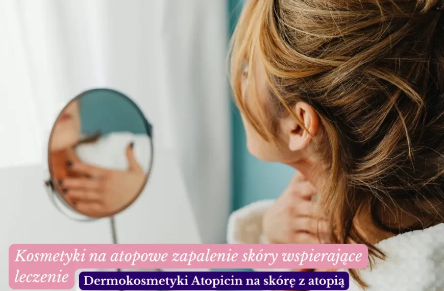 Kosmetyki na atopowe zapalenie skóry