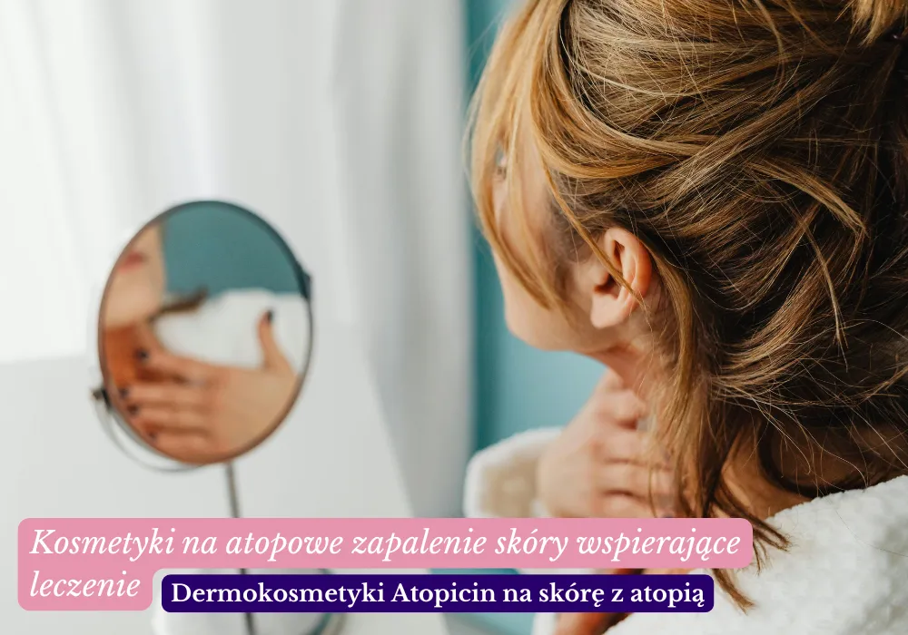 Kosmetyki na atopowe zapalenie skóry