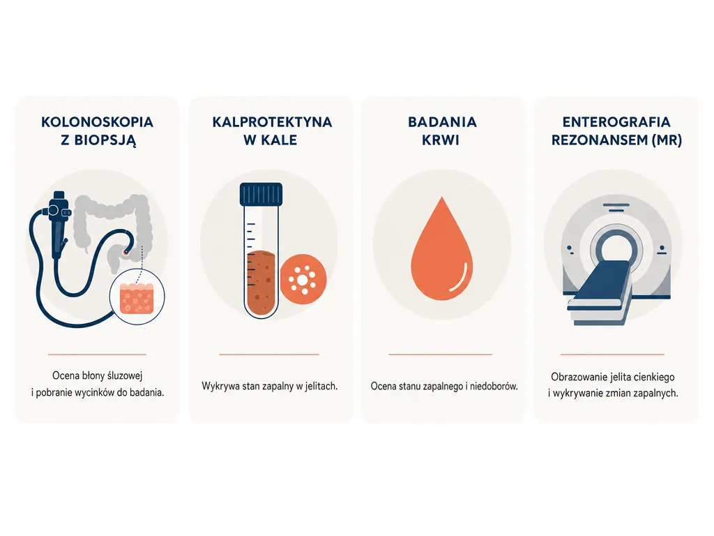 Infografika porównująca cztery metody diagnostyki choroby Crohna: kolonoskopia z wycinkami, kalprotektyna w kale, badania krwi i enterografia rezonansem magnetycznym