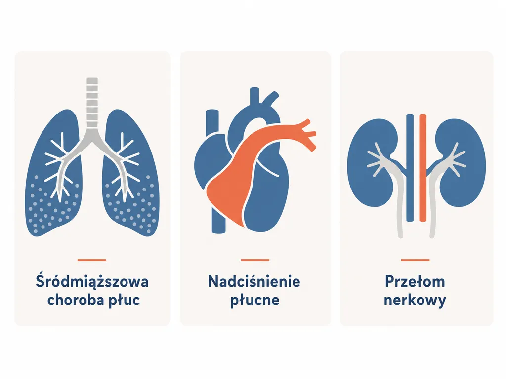 Diagram trzech najgroźniejszych powikłań narządowych twardziny: płuca, serce i nerki