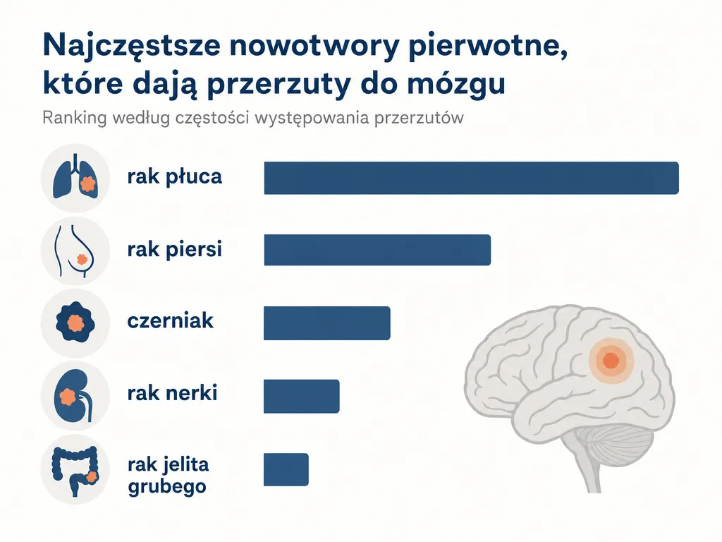 Infografika przedstawiająca najczęstsze nowotwory pierwotne dające przerzuty do mózgu: rak płuca, rak piersi, czerniak, rak nerki, rak jelita grubego