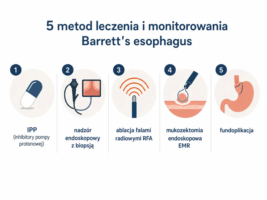 Infografika przedstawiająca pięć metod leczenia i nadzoru przełyku Barretta