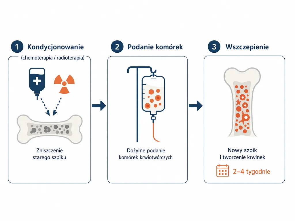 Diagram trzech etapów przeszczepu szpiku: kondycjonowanie, podanie komórek i wszczepienie