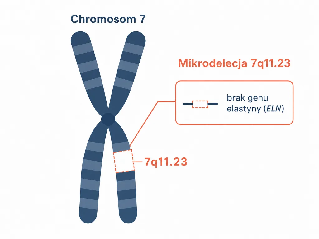 Diagram genetyczny pokazujący mikrodelecję regionu 7q11.23 na chromosomie 7 i brak genu elastyny