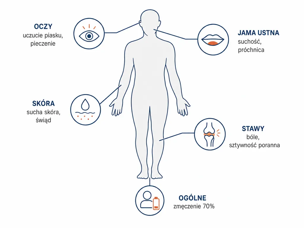 Diagram sylwetki człowieka z oznaczonymi grupami objawów zespołu Sjögrena: oczy, jama ustna, skóra, stawy i objawy ogólne