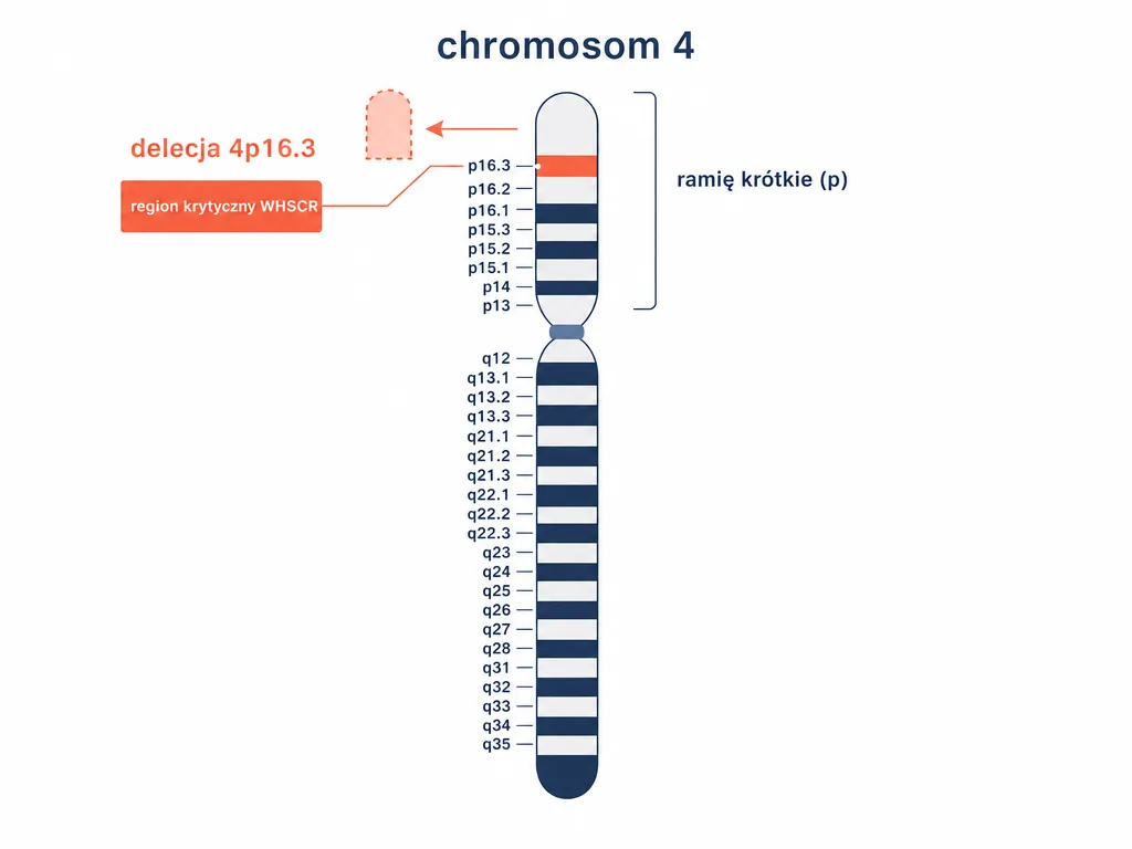 Diagram chromosomu 4 z zaznaczoną delecją regionu 4p16.3 i regionem krytycznym WHSCR
