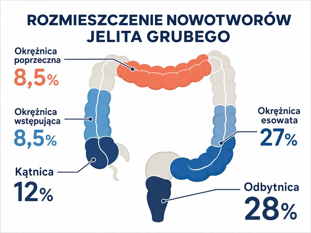 Infografika anatomiczna pokazująca rozkład lokalizacji raka jelita grubego z odsetkami dla odbytnicy, okrężnicy esowatej, kątnicy i innych
