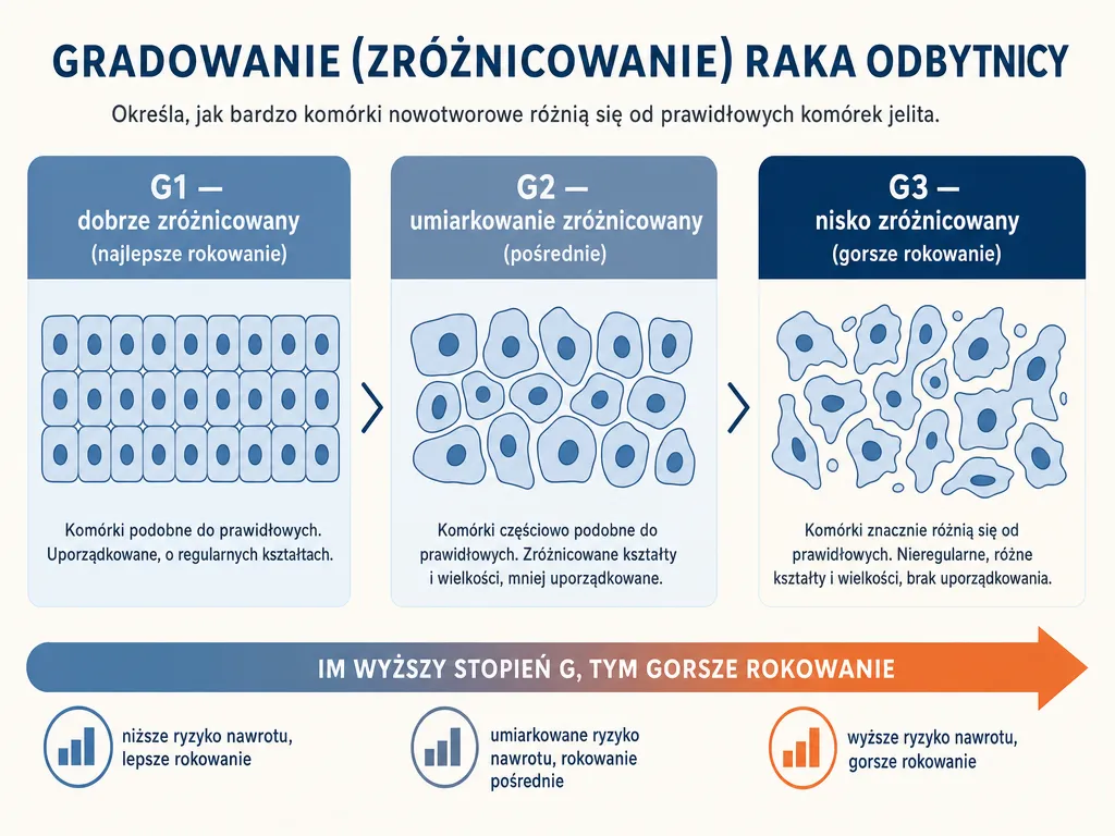 Infografika wyjaśniająca stopnie zróżnicowania histologicznego raka odbytnicy G1, G2 i G3 oraz ich wpływ na rokowanie