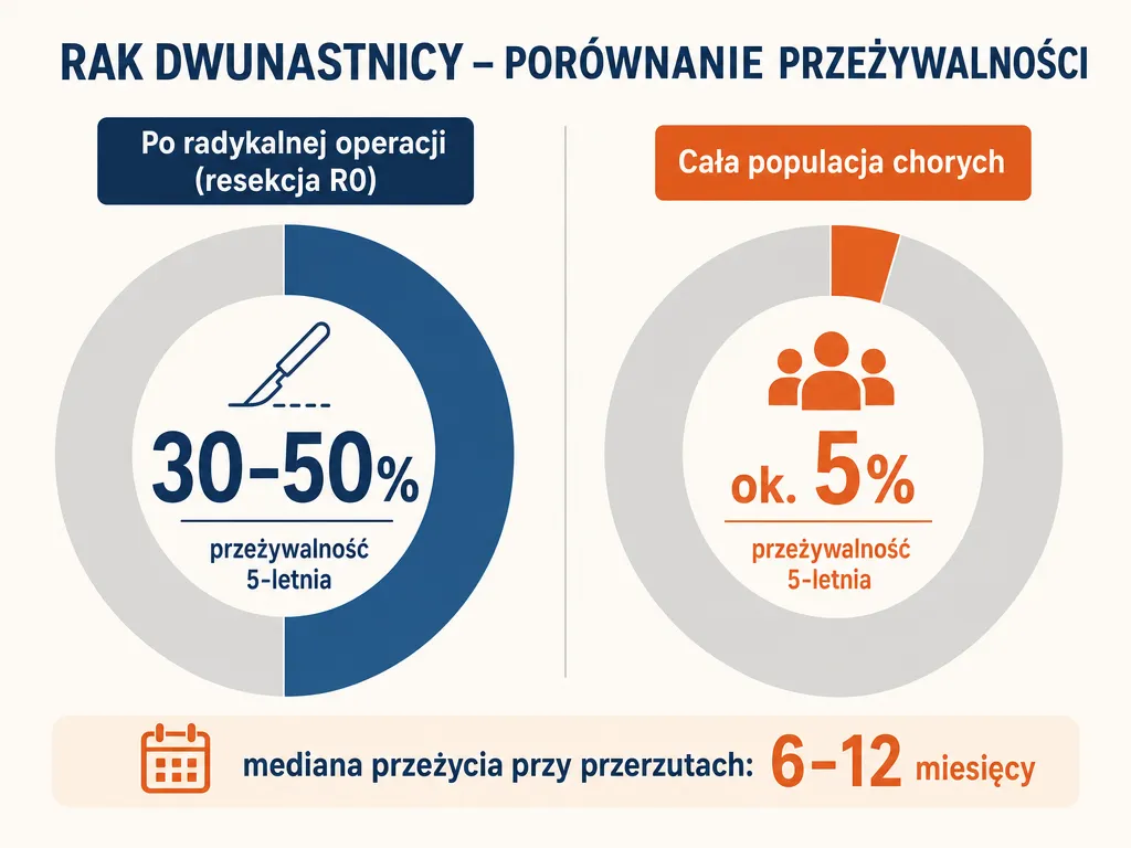 Infografika porównująca 5-letnią przeżywalność w raku dwunastnicy po operacji radykalnej (30-50%) i w całej populacji chorych (ok. 5%)