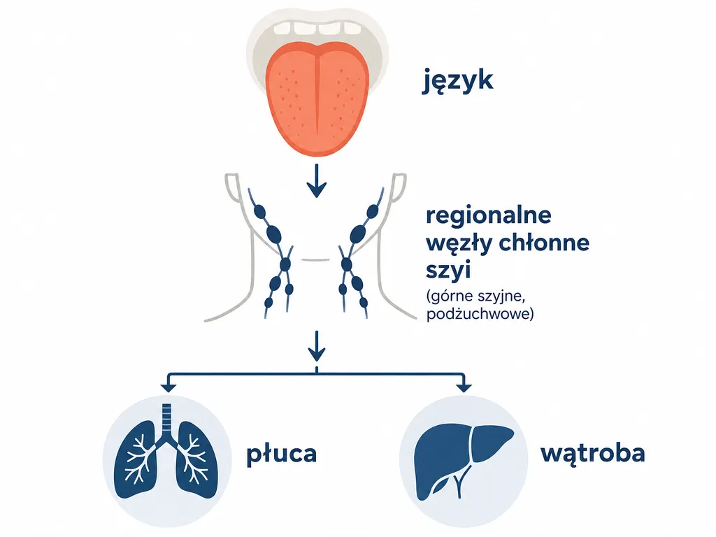 Diagram szlaku przerzutów raka języka: od języka do węzłów chłonnych szyi, następnie do płuc i wątroby